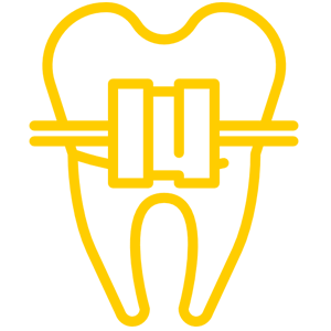 Braces Treatment